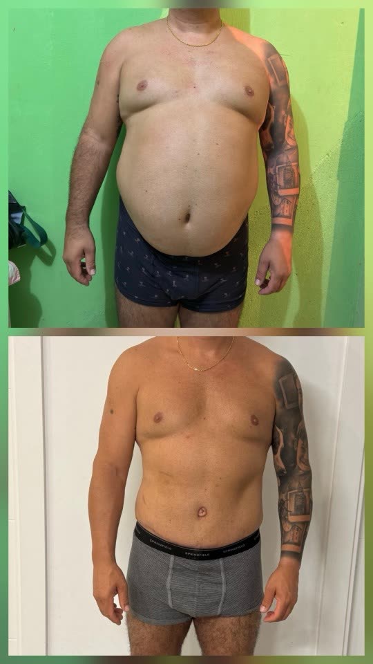 Antes y después de Antonio